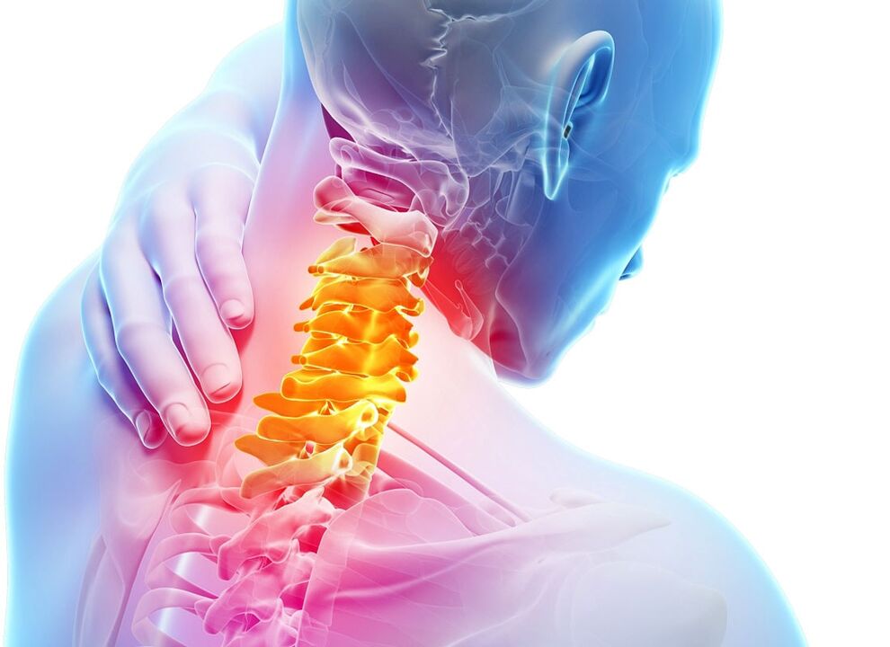 dzemdes kakla osteohondrozes simptomi